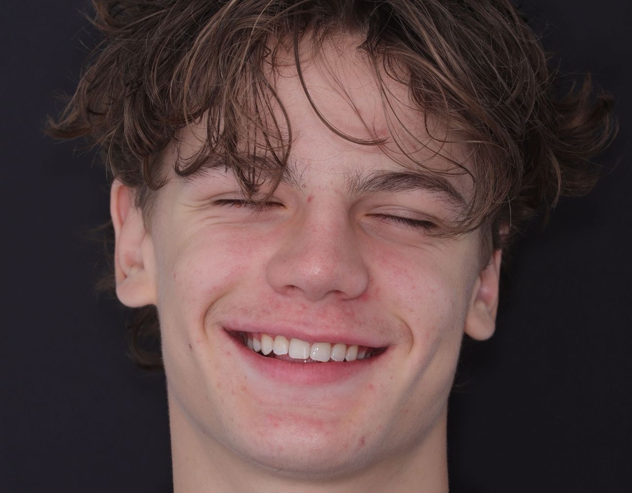 after-braces-2.jpg