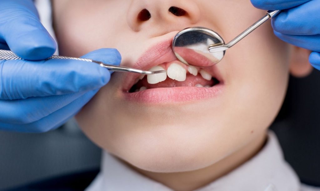 dentists for children teeth